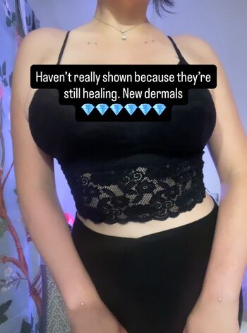 🔥 Adept page leaked private photo uncensored full