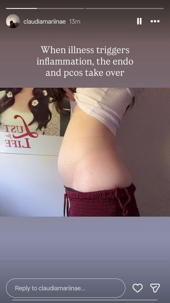 🔥 Claumarii claudicloud leaked private photo uncensored full