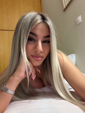 🔥 Dwwwra leaked private photo uncensored full