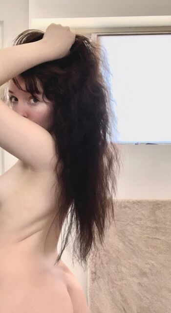 🔥 Hospitalchan leaked private photo uncensored full