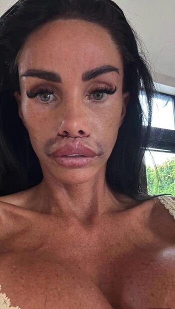 🔥 Katie price  page leaked private photo uncensored full