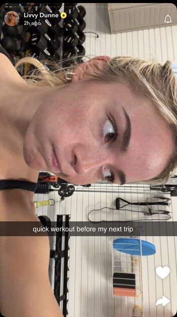 🔥 Livvy dunne  page leaked private photo uncensored full