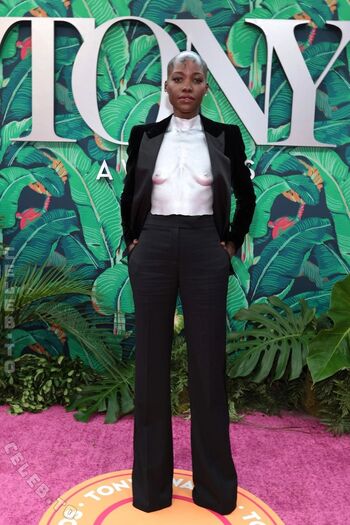 🔥 Lupita nyong o page leaked private photo uncensored full