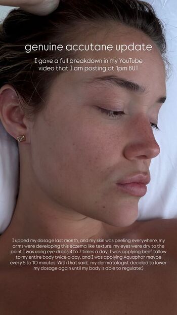 🔥 Olivia ponton page leaked private photo uncensored full