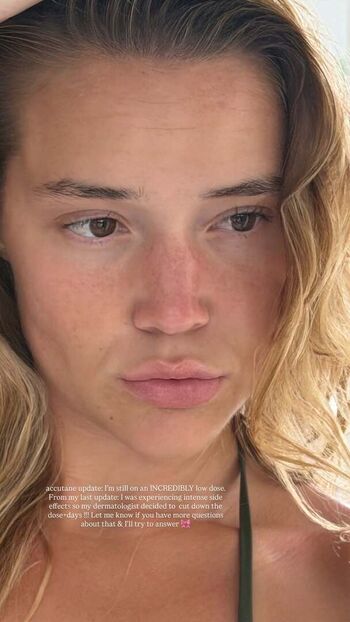 🔥 Olivia ponton page leaked private photo uncensored full