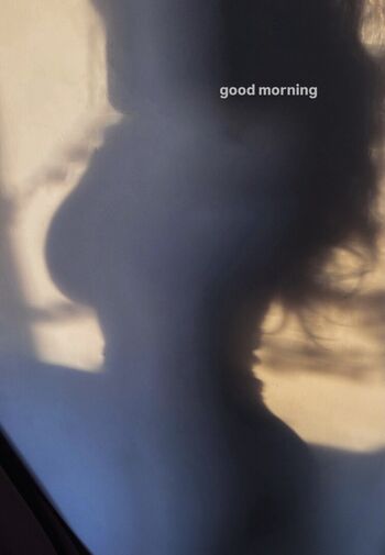 🔥 Robyn  page leaked private photo uncensored full