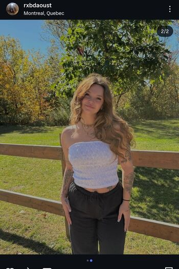 🔥 Rxbdaoust page leaked private photo uncensored full