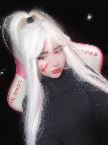 🔥 Whyklayn leaked private photo uncensored full